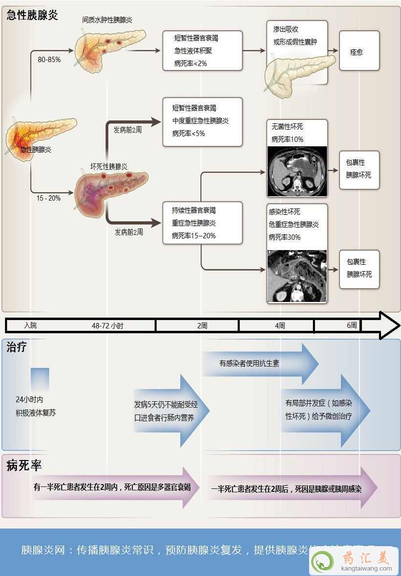 急性胰腺炎死亡率高嗎 急性胰腺炎死亡率高嗎